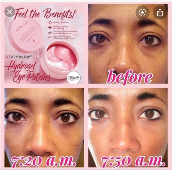 Eye patches - Picture 5 of 7